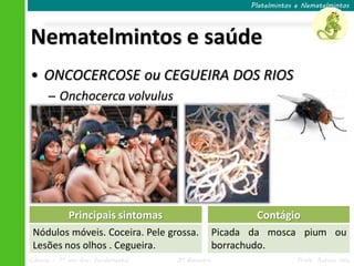Ciências – 7º ano Ens. Fundamental 3º Bimestre Profa. Rebeca Vale
Nematelmintos e saúde
Platelmintos e Nematelmintos
• ONCOCERCOSE ou CEGUEIRA DOS RIOS
─ Onchocerca volvulus
Principais sintomas
Nódulos móveis. Coceira. Pele grossa.
Lesões nos olhos . Cegueira.
Contágio
Picada da mosca pium ou
borrachudo.
 