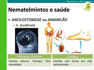 Ciências – 7º ano Ens. Fundamental 3º Bimestre Profa. Rebeca Vale
Nematelmintos e saúde
Platelmintos e Nematelmintos
• ANCILOSTOMOSE ou AMARELÃO
─ A. duodenale
Principais sintomas
Anemia intensa. Cansaço. Pele
amarelada.
Contágio
Contato com larvas em solo
contaminado.
 