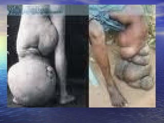 Platelmintos e nematelmintos 