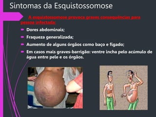 Sintomas da Esquistossomose
A esquistossomose provoca graves consequências para
pessoa infectada:
 Dores abdominais;
 Fraqueza generalizada;
 Aumento de alguns órgãos como baço e fígado;
 Em casos mais graves-barrigão: ventre incha pelo acúmulo de
água entre pele e os órgãos.
 