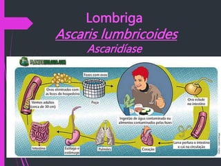 Lombriga
Ascaris lumbricoides
Ascaridíase
 