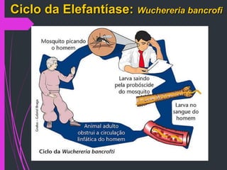 Ciclo da Elefantíase: Wuchereria bancrofi
 