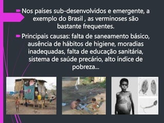 Nos países sub-desenvolvidos e emergente, a
exemplo do Brasil , as verminoses são
bastante frequentes.
Principais causas: falta de saneamento básico,
ausência de hábitos de higiene, moradias
inadequadas, falta de educação sanitária,
sistema de saúde precário, alto índice de
pobreza...
 