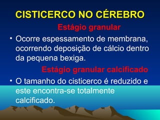 CISTICERCO NO CÉREBRO
Estágio granular
• Ocorre espessamento de membrana,
ocorrendo deposição de cálcio dentro
da pequena bexiga.
Estágio granular calcificado
• O tamanho do cisticerco é reduzido e
este encontra-se totalmente
calcificado.

 