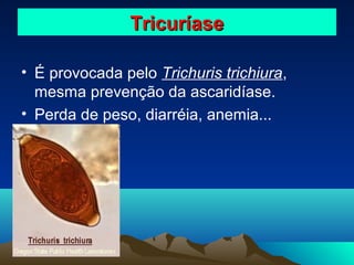 Tricuríase
• É provocada pelo Trichuris trichiura,
mesma prevenção da ascaridíase.
• Perda de peso, diarréia, anemia...

 