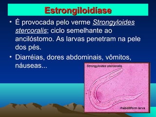 Estrongiloidíase
• É provocada pelo verme Strongyloides
stercoralis; ciclo semelhante ao
ancilóstomo. As larvas penetram na pele
dos pés.
• Diarréias, dores abdominais, vômitos,
náuseas...

 