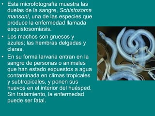 • Esta microfotografía muestra las
duelas de la sangre, Schistosoma
mansoni, una de las especies que
produce la enfermedad llamada
esquistosomiasis.
• Los machos son gruesos y
azules; las hembras delgadas y
claras.
• En su forma larvaria entran en la
sangre de personas o animales
que han estado expuestos a agua
contaminada en climas tropicales
y subtropicales, y ponen sus
huevos en el interior del huésped.
Sin tratamiento, la enfermedad
puede ser fatal.
 
