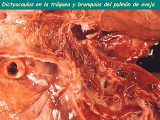 Dictyocaulus en la tráquea y bronquios del pulmón de oveja
 