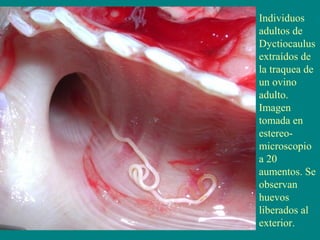 Individuos
adultos de
Dyctiocaulus
extraídos de
la traquea de
un ovino
adulto.
Imagen
tomada en
estereo-
microscopio
a 20
aumentos. Se
observan
huevos
liberados al
exterior.
 
