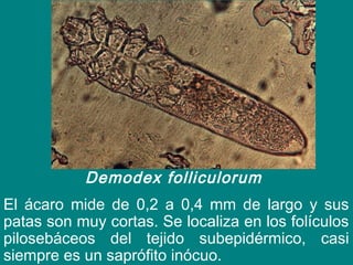 Demodex folliculorum 
El ácaro mide de 0,2 a 0,4 mm de largo y sus
patas son muy cortas. Se localiza en los folículos
pilosebáceos del tejido subepidérmico, casi
siempre es un saprófito inócuo.
 