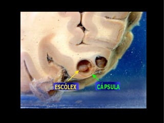 Alojam-se dentro dos vasos sangüíneos do fígado ou do baço e se nutrem de sangue.  