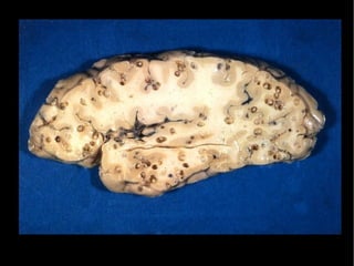 Provocam um derramamento de líquidos no abdome do hospedeiro, levando ao inchaço da região abdominal ( “barriga d`água” ). 