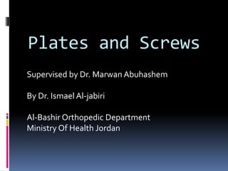 Plates and Screws
Supervised by Dr. Marwan Abuhashem
By Dr. Ismael Al-jabiri
Al-Bashir Orthopedic Department
Ministry Of Health Jordan
 