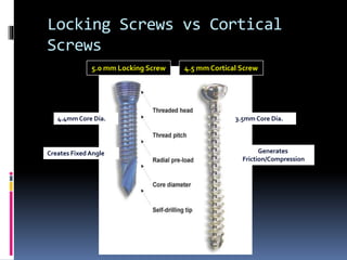 AO/ASIF Screws: Types
 Cortical
 Fully threaded
 Shaft screw
 1.5:phalanx *drill bit 1.1 mm
 2.7: mc and phalanx *bit...