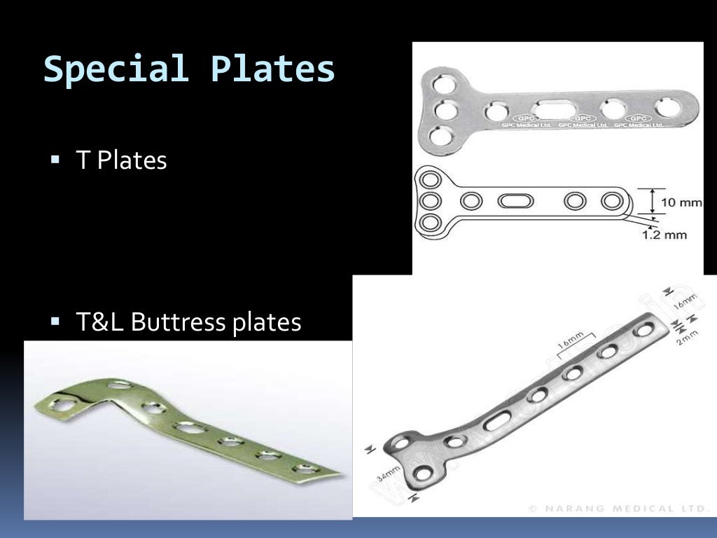 Plates and screws 11