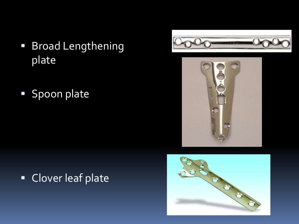 Plates and screws 11