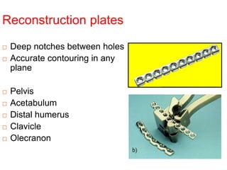 Reconstruction plates
 Deep notches between holes
 Accurate contouring in any
plane
 Pelvis
 Acetabulum
 Distal humerus
 Clavicle
 Olecranon
 