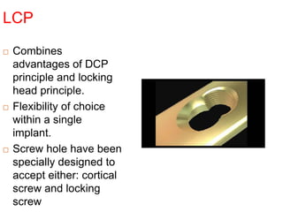 LCP
 Combines
advantages of DCP
principle and locking
head principle.
 Flexibility of choice
within a single
implant.
 Screw hole have been
specially designed to
accept either: cortical
screw and locking
screw
 