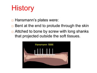 History
 Hansmann’s plates were:
 Bent at the end to protude through the skin
 Attched to bone by screw with long shanks
that projected outside the soft tissues.
 