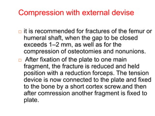 Compression with external devise
 it is recommended for fractures of the femur or
humeral shaft, when the gap to be closed
exceeds 1–2 mm, as well as for the
compression of osteotomies and nonunions.
 After fixation of the plate to one main
fragment, the fracture is reduced and held in
position with a reduction forceps. The tension
device is now connected to the plate and fixed
to the bone by a short cortex screw.and then
after comression another fragment is fixed to
plate.
 