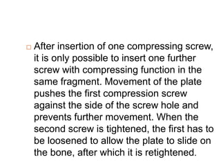  After insertion of one compressing screw,
it is only possible to insert one further
screw with compressing function in the
same fragment. Movement of the plate
pushes the first compression screw
against the side of the screw hole and
prevents further movement. When the
second screw is tightened, the first has to
be loosened to allow the plate to slide on
the bone, after which it is retightened.
 