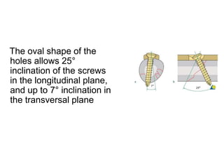 The oval shape of the
holes allows 25°
inclination of the screws
in the longitudinal plane,
and up to 7° inclination in
the transversal plane
 