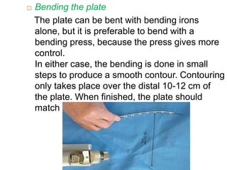  Bending the plate
The plate can be bent with bending irons
alone, but it is preferable to bend with a
bending press, because the press gives more
control.
In either case, the bending is done in small
steps to produce a smooth contour. Contouring
only takes place over the distal 10-12 cm of
the plate. When finished, the plate should
match the 20 cm radius of curvature.
 