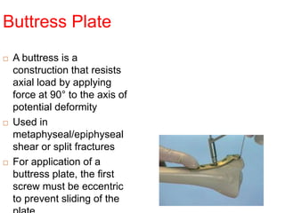Buttress Plate
 A buttress is a
construction that resists
axial load by applying
force at 90° to the axis of
potential deformity
 Used in
metaphyseal/epiphyseal
shear or split fractures
 For application of a
buttress plate, the first
screw must be eccentric
to prevent sliding of the
 