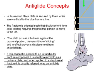 Antiglide Concepts
• In this model black plate is secured by three white
screws distal to the blue fracture line.
• The fracture is oriented such that displacement from
axial loading requires the proximal portion to move
to the left.
• The plate acts as a buttress against the
proximal portion, prevents it from “sliding”
and in effect prevents displacement from
an axial load.
• If this concept is applied to an intraarticular
fracture component it is usually referred to as a
buttress plate, and when applied to a diaphyseal
fracture it is usually referred to as an antiglide
plate.
 
