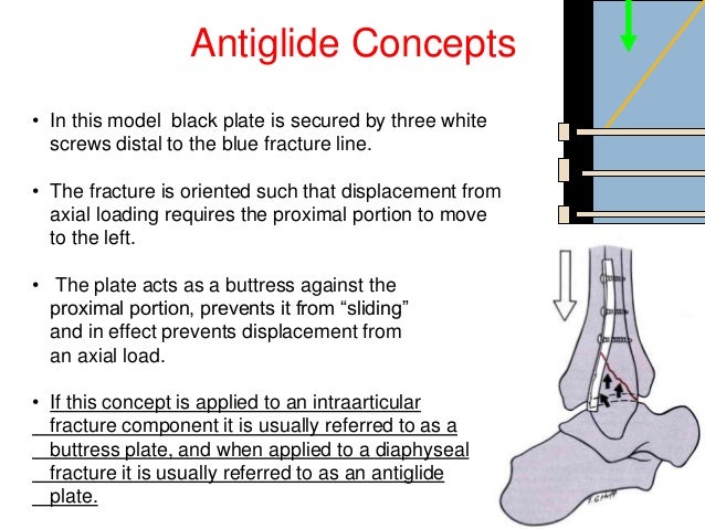antiglide plate