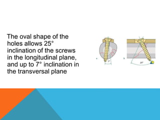 The oval shape of the
holes allows 25°
inclination of the screws
in the longitudinal plane,
and up to 7° inclination in
the transversal plane
 