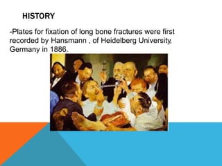 HISTORY
-Plates for fixation of long bone fractures were first
recorded by Hansmann , of Heidelberg University,
Germany in 1886.
 