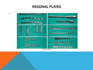 REGIONAL PLATES
.
 