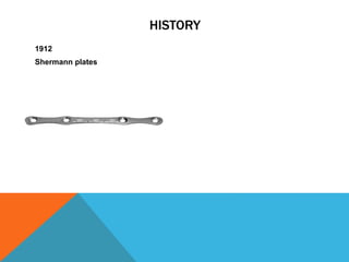 HISTORY
1912
Shermann plates
 