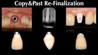 Copy&Past Re-Finalization