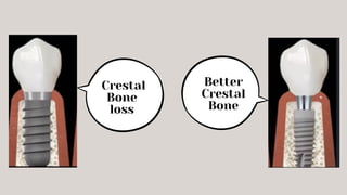 Better
Crestal
Bone
Crestal
Bone
loss
 