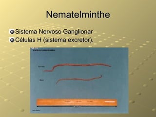 Nematelminthe Sistema Nervoso Ganglionar Células H (sistema excretor). 