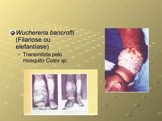 Wuchereria bancrofti  (Filariose ou elefantíase) Transmitida pelo mosquito  Culex sp . 