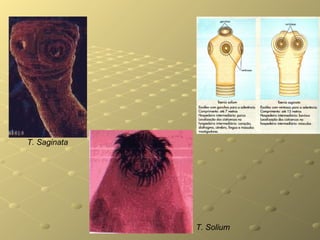 T. Saginata   T. Solium   