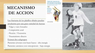MECANISMO
DE ACCION
Las fracturas de los platillos tibiales pueden
producirse por una gran variedad de fuerzas.
- Valgo y varo forzados
- Compresión axial
- Flexión / Extensión
- Traumatismo directo
Existen dos subgrupos
Pacientes jóvenes con buen hueso - alta energía
Pacientes ancianos con osteoporosis - baja energía
 