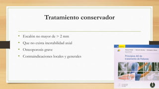 Tratamiento conservador
• Escalón no mayor de > 2 mm
• Que no exista inestabilidad axial
• Osteoporosis grave
• Contraindicaciones locales y generales
 