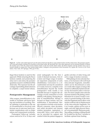 Plating of the distal radius | PDF