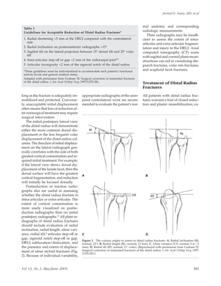 long as the fracture is adequately im-
mobilized and protected. Converse-
ly, unacceptable initial displacement
often means that loss of reduction af-
ter nonsurgical treatment may require
surgical intervention.
The initial postinjury lateral view
of the distal radius will demonstrate
either the more common dorsal dis-
placement or the less frequent volar
displacement of the distal radius col-
umns. The direction of initial displace-
ment on the lateral radiograph gen-
erally correlates with the side of both
greatest cortical comminution and re-
quired initial treatment. For example,
if the lateral view shows dorsal dis-
placement of the lunate facet, then the
dorsal surface will have the greatest
cortical fragmentation, and reduction
will initially be focused dorsally.
Postreduction or traction radio-
graphs also are useful in assessing
whether the distal radius fracture is
intra-articular or extra-articular. The
extent of cortical comminution is
more easily visualized on postre-
duction radiographs than on initial
postinjury radiographs.11 All plain ra-
diographs of distal radius fractures
should include evaluation of radial
inclination, radial length, ulnar vari-
ance, radial tilt,9 articular step-off or
gap, sigmoid notch step-off or gap,
DRUJ subluxation/dislocation, and
the presence and extent of displace-
ment of ulnar styloid fractures (Fig.
2). Because of individual variability,
appropriate radiographs of the unin-
jured contralateral wrist are recom-
mended to evaluate the patient’s nor-
mal anatomy and corresponding
radiologic measurements.
Plain radiographs may be insuffi-
cient to assess the extent of intra-
articular and extra-articular fragmen-
tation and injury to the DRUJ. Axial
computed tomography (CT) scans
with sagittal and coronal plane recon-
structions can aid in visualizing die-
punch fractures, volar rim fractures,
and scaphoid facet fractures.
Treatment of Distal Radius
Fractures
All patients with distal radius frac-
tures warrant a trial of closed reduc-
tion and plaster immobilization; ex-
Table 1
Guidelines for Acceptable Reduction of Distal Radius Fractures*
1. Radial shortening <5 mm at the DRUJ compared with the contralateral
side
2. Radial inclination on posteroanterior radiographs >15°
3. Sagittal tilt on the lateral projection between 15° dorsal tilt and 20° volar
tilt
4. Intra-articular step-off or gap <2 mm of the radiocarpal joint10
5. Articular incongruity <2 mm of the sigmoid notch of the distal radius
*These guidelines must be individualized to accommodate each patient’s functional
activity levels and general medical status.
Adapted with permission from Graham TJ: Surgical correction of malunited fractures
of the distal radius. J Am Acad Orthop Surg 1997;5:270-281.
Figure 2 The various angles to assess in distal radius fractures. A, Radial inclination (RI;
normal, 22°). B, Radial length (RL; normal, 12 mm). C, Ulnar variance (UV; normal, 0 to −2
mm). D, Radial tilt (RT; normal, 11° volar). (Reproduced with permission from Graham TJ:
Surgical correction of malunited fractures of the distal radius. J Am Acad Orthop Surg 1997;
5:270-281.)
Arvind D. Nana, MD, et al
Vol 13, No 3, May/June 2005 161
 