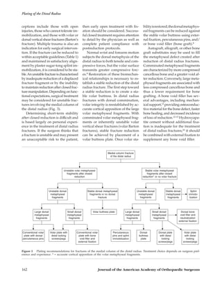 ceptions include those with open
injuries, those who cannot tolerate im-
mobilization, and those with volar or
dorsalverticalshearfractures(Barton’s
fracture). Multiple trauma is also an
indication for early surgical interven-
tion. If the fracture can be reduced to
within acceptable guidelines (Table 1)
and maintained in satisfactory align-
ment by plaster sugar-tong splint im-
mobilization, it is considered to be sta-
ble.Anunstablefractureischaracterized
by inadequate reduction of a displaced
fracture fragment or by the inability
to maintain reduction after closed frac-
turemanipulation.Dependingonfunc-
tional expectations, surgical treatment
may be considered for unstable frac-
tures involving the medial column of
the distal radius (Fig. 3).
Determining short-term stability
after closed reduction is difficult and
is based largely on personal experi-
ence in the treatment of distal radius
fractures. If the surgeon thinks that
a fracture is unstable and may present
an unacceptable risk to the patient,
then early open treatment with ﬁx-
ation should be considered. Success-
ful closed treatment requires attention
to detail by the physician as well as
complete patient compliance with
postreduction protocols.
Normal wrist and forearm motion
subjects the dorsal metaphysis of the
distal radius to both tensile and com-
pressive forces, but the volar surface
transmits greater compressive forc-
es.8 Restoration of these biomechan-
ical relationships is necessary to es-
tablish a stable reduction of the distal
radius fracture. The ﬁrst step toward
a stable reduction is to create a sta-
ble volar buttress. In distal radius
fractures with dorsal comminution,
volar integrity is reestablished by ac-
curate cortical apposition of the large
volar metaphyseal fragments. With
comminuted volar metaphyseal frag-
ments or inherently unstable volar
vertical shear fractures (volar Barton
fractures), stable fracture reduction
can be achieved by placement of a
volar buttress plate. Once volar sta-
bilityisrestored,thedorsalmetaphys-
eal fragments can be reduced against
the stable volar buttress using exter-
nal ﬁxation, percutaneous pins, and/
or bone void ﬁller (bone graft).8
Autograft, allograft, or other bone
graft substitutes may be used to ﬁll
the metaphyseal defect created after
reduction of distal radius fractures.
Comminuted metaphyseal fragments
are characterized by more compressed
cancellous bone and a greater void af-
ter reduction. Conversely, large meta-
physeal fragments are associated with
less compressed cancellous bone and
thus a lower requirement for bone
grafting. A bone void ﬁller has sev-
eral advantages, including mechan-
ical support,12 providing osteoconduc-
tive material for the bone defect, faster
bone healing, and decreased incidence
of loss of reduction.12-15 Hydroxyapa-
tite cement without additional ﬁxa-
tion is inadequate for the treatment
of distal radius fractures;16 it should
be combined with external ﬁxation to
supplement any bone void ﬁller.
Volar buttress plate
Medial column fracture
of the distal radius
Large dorsal
metaphyseal
fragments
Unstable dorsal
metaphyseal
fragments
Stable dorsal metaphyseal
fragments or no dorsal
fracture
Small dorsal
metaphyseal
fragments
Percutaneous
pins and splint
immobilization
Splint
immobi-
lization
Stable volar metaphyseal
fragments after closed
reduction* or no volar fracture
Unstable volar metaphyseal
fragments after closed
reduction
Conventional volar
plate with dorsal
percutaneous pins
Volar plate with
distal locking
screws/pegs
Small dorsal
metaphyseal
fragments
Large dorsal
metaphyseal
fragments
Unstable dorsal
metaphyseal
fragments
Stable dorsal
metaphyseal
fragments
Volar plate
with distal
locking
screws/pegs
Dorsal plate
with distal
locking
screws/pegs
Conventional volar
plate with bone
void filler and
external fixation
Dorsal
buttress
plate
Dorsal bone
void filler and
neutralization
external fixation
Figure 3 Plating recommendations for fractures of the medial column of the distal radius. Treatment choice depends on surgeon pref-
erence and experience. * = accurate cortical apposition of the volar metaphyseal fragments.
Plating of the Distal Radius
162 Journal of the American Academy of Orthopaedic Surgeons
 