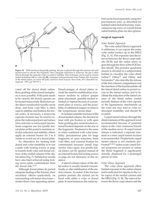 vated off the dorsal distal radius.
Bone grafting of the dorsal metaphy-
sis is now possible. If the joint needs
to be viewed, the dorsal capsule can
be incised transversely. Reduction un-
der direct visualization usually can be
done, and bone void ﬁller is often
used to stabilize and buttress the dor-
sal cortex. If necessary, a transverse
capsular incision may be used to ex-
plore the radiocarpal joint and reduce
intra-articular or intracarpal injuries.
Some surgeons use low-proﬁle dor-
sal plates at this point to maintain ar-
ticular reduction and stability; others
apply an external ﬁxator for 3 to 4
weeks to avoid use of a dorsal plate.
An alternative for treating both
dorsal and volar instability is to use
a plate with locking screws or pegs
to transﬁx both volar and dorsal cor-
tices of the medial column of the dis-
tal radius (Fig. 7). Satisfactory results
have also been achieved using lock-
ing screw–plate combinations from
the dorsal side.22-24
Although dorsal plates do permit
adequate healing of the fracture, their
secondary effects—particularly on
surrounding soft-tissue structures—
render them a less appealing option.
Disadvantages of dorsal plates in-
clude the need for mobilization of ex-
tensor tendons to achieve proper
plate placement, possible tendon ir-
ritation or rupture because of a prom-
inent plate or screws, and the possi-
bility of additional surgery to remove
the symptomatic dorsal plate.
In isolated unstable fractures of the
dorsal medial column, the decision to
treat with pin ﬁxation or with open
bone grafting plus neutralization ex-
ternal ﬁxation depends on the size of
the fragments. Treatment is the same
as when combined with volar insta-
bility: percutaneous pins for large
fragments or open reduction, bone
void ﬁller, and external ﬁxation for
comminuted fractures (small frag-
ments). Once again, low-proﬁle dor-
sal plates can be applied instead of
an external ﬁxator, but locking screws
or pegs are not necessary in this in-
stance.
A lateral column injury of the dis-
tal radius is usually treated concom-
itantly or after stabilization of the me-
dial column. As noted, if the fracture
pattern permits, the styloid can be
ﬁxed with either a volar or dorsal
plate. In most instances, the radial sty-
loid can be ﬁxed separately using two
percutaneous pins, as described for
isolatedradialstyloidfractures.Aper-
cutaneous lag screw or a small dorsal
radial buttress plate are also options.
Surgical Approach
Volar Radial Approach
The volar radial (Henry) approach
is utilitarian; it can expose the entire
volar radial surface up to the DRUJ
(Fig. 11, A). This exposure uses the in-
terval between the ﬂexor carpi radi-
alis (FCR) and the radial artery or
goes through the ﬂoor of the FCR ten-
don sheath. The pronator quadratus
muscle is elevated in a subperiosteal
fashion to visualize the volar distal
radius.25 Orbay26 and Orbay and
Fernandez27 also describe the release
of the ﬁrst extensor compartment and
the insertion of the brachioradialis off
the lateral distal radius to permit ac-
cess to the dorsal surface and to fa-
cilitate the reduction of the lateral col-
umn of the distal radius (radial
styloid). Release of the volar capsule
or the ligamentous attachments on
the volar rim may lead to volar ra-
diocarpal instability and should be
avoided.
Carpal tunnel release through the
distal extension of this approach is not
recommended because of potential
injury to the volar cutaneous branch
of the median nerve. If carpal tunnel
release is indicated, a separate stan-
dard or a mini carpal tunnel incision
is recommended. Prophylactic carpal
tunnel release is not routinely per-
formed21,28,29 unless acute carpal tun-
nel symptoms are present or unless
the distal fragment is signiﬁcantly
dorsally displaced for a prolonged
period of time.
Volar Ulnar Approach
The volar ulnar approach offers
limited exposure to the radial column
and is indicated for injuries to the vo-
lar aspect of the medial column and
the DRUJ (Fig. 11, B). The interval be-
tween the ﬂexor carpi ulnaris and the
Figure 10 With intrafocal Kapandji pinning, the pin is placed through the fracture site and
maneuvered to elevate the fragment. Once adequate reduction is achieved, the pin is then
driven through the opposite cortex to achieve stability. This technique can be used to restore
radial inclination (A) or volar tilt (B). (Adapted with permission from Palmer AK: Fractures
of the distal radius, in Green DP [ed]: Operative Hand Surgery. New York, NY: Churchill Liv-
ingstone, 1993, pp 929-971.)
Arvind D. Nana, MD, et al
Vol 13, No 3, May/June 2005 167
 