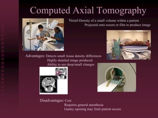 Computed Axial Tomography
Voxel-Density of a small volume within a patient
Projected onto screen or film to produce image
Advantages: Detects small tissue density differences
Highly detailed image produced
Ability to see deep/small changes
Disadvantages: Cost
Requires general anesthesia
Gantry opening may limit patient access
 