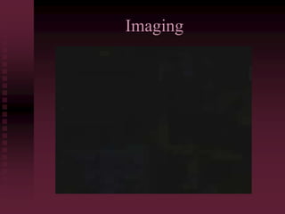 Imaging
 