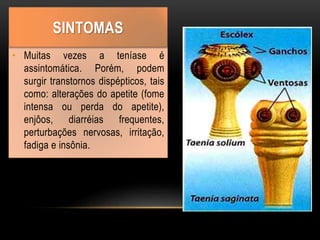 • Muitas vezes a teníase é
assintomática. Porém, podem
surgir transtornos dispépticos, tais
como: alterações do apetite (fome
intensa ou perda do apetite),
enjôos, diarréias frequentes,
perturbações nervosas, irritação,
fadiga e insônia.
SINTOMAS
 