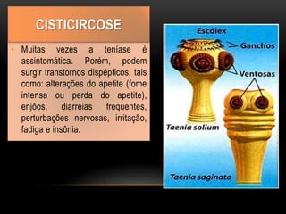 • Muitas vezes a teníase é
assintomática. Porém, podem
surgir transtornos dispépticos, tais
como: alterações do apetite (fome
intensa ou perda do apetite),
enjôos, diarréias frequentes,
perturbações nervosas, irritação,
fadiga e insônia.
CISTICIRCOSE
 