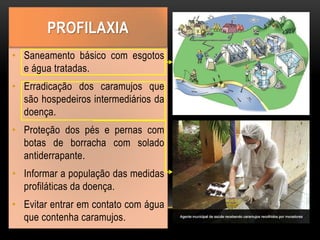 • Saneamento básico com esgotos
e água tratadas.
• Erradicação dos caramujos que
são hospedeiros intermediários da
doença.
• Proteção dos pés e pernas com
botas de borracha com solado
antiderrapante.
• Informar a população das medidas
profiláticas da doença.
• Evitar entrar em contato com água
que contenha caramujos.
PROFILAXIA
 